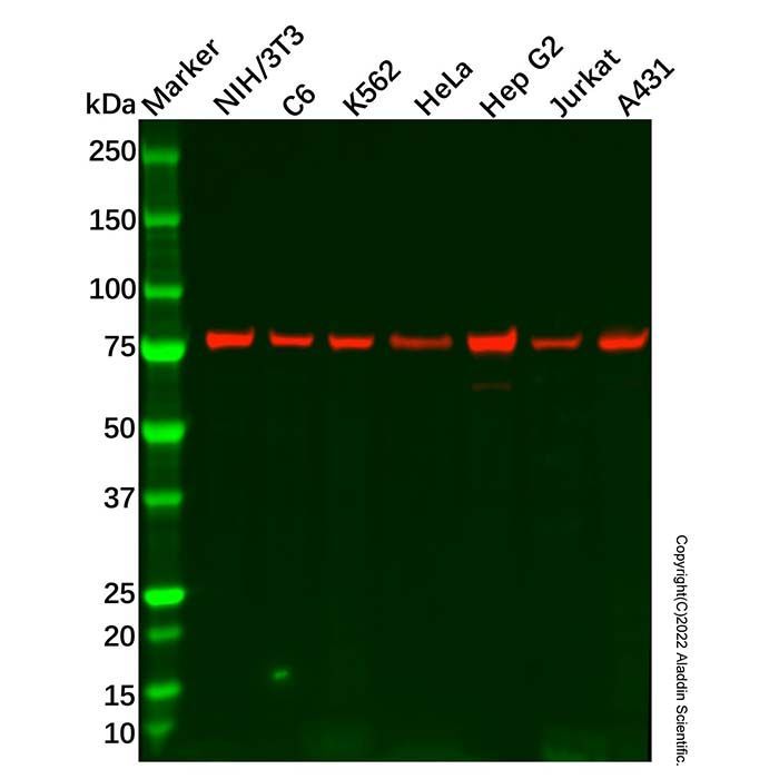 Recombinant Radixin/RDX Antibody -    by Aladdin Scientific
