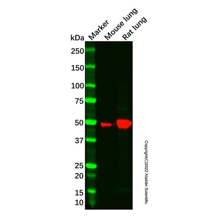 Recombinant RAGE Antibody -    by Aladdin Scientific
