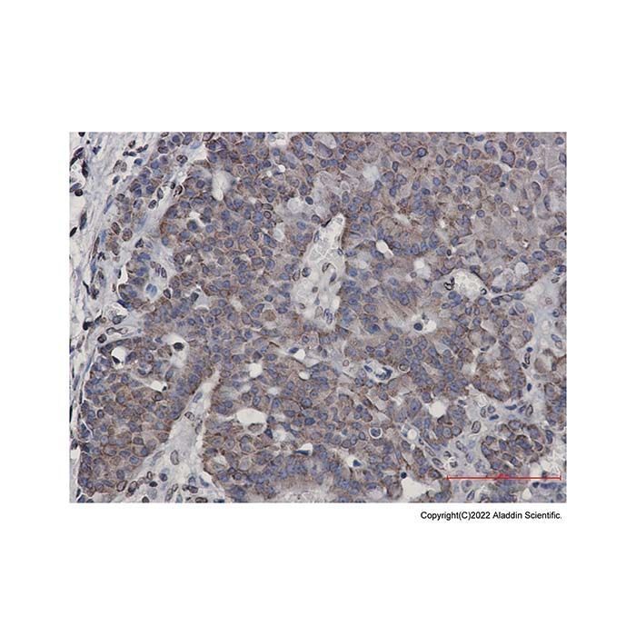 Recombinant RAP80 Antibody -    by Aladdin Scientific