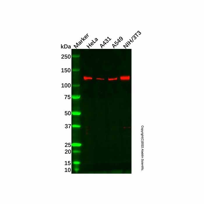 Recombinant RASA1 Antibody -    by Aladdin Scientific