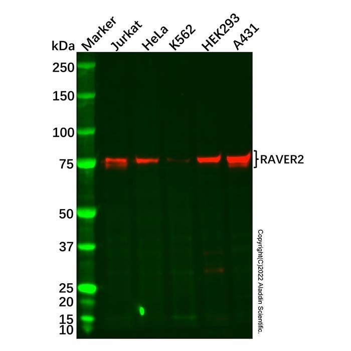 Recombinant RAVER2 Antibody -    by Aladdin Scientific