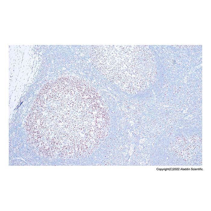 Recombinant Rb Antibody -    by Aladdin Scientific