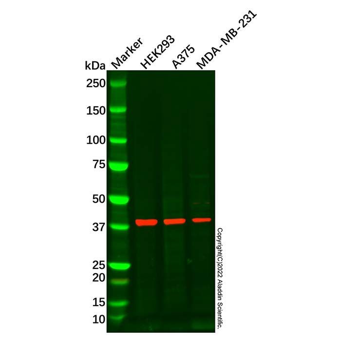 RBM4 Antibody -    by Aladdin Scientific