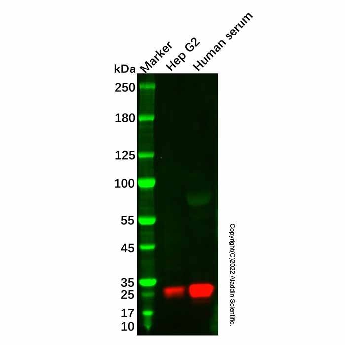 Recombinant RBP4 Antibody -    by Aladdin Scientific