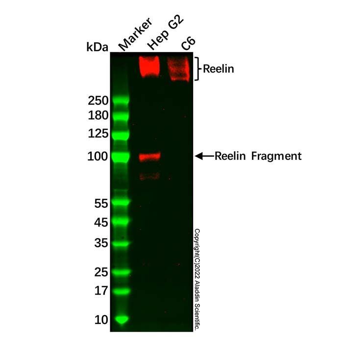 Recombinant Reelin Antibody -    by Aladdin Scientific