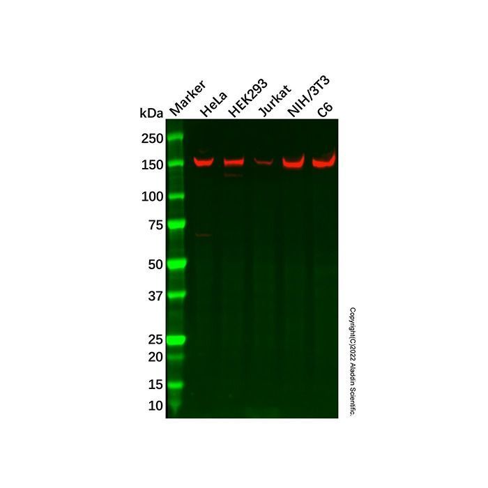 Recombinant REST/NRSF Antibody -    by Aladdin Scientific
