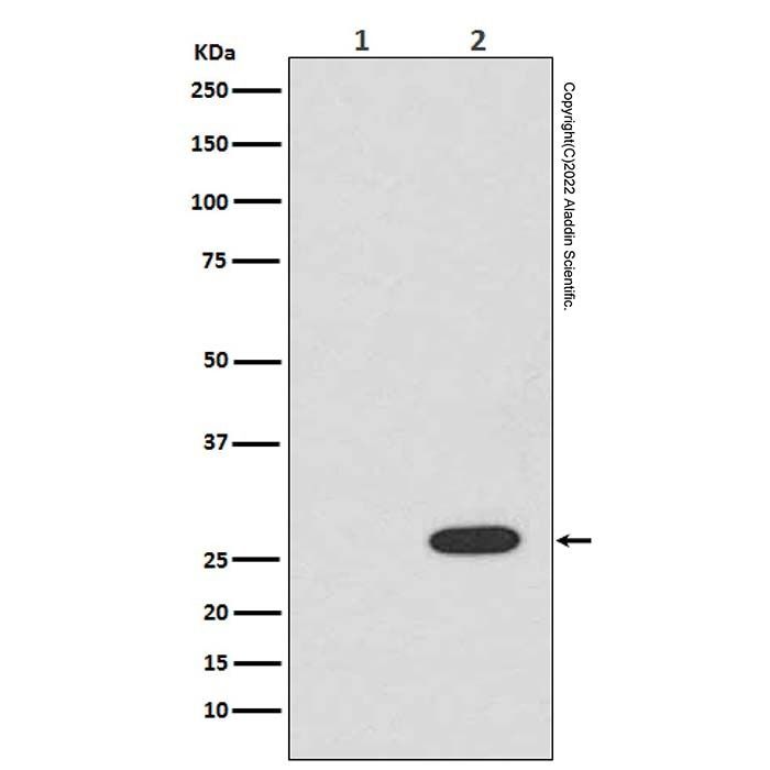 Recombinant RFP Antibody -    by Aladdin Scientific