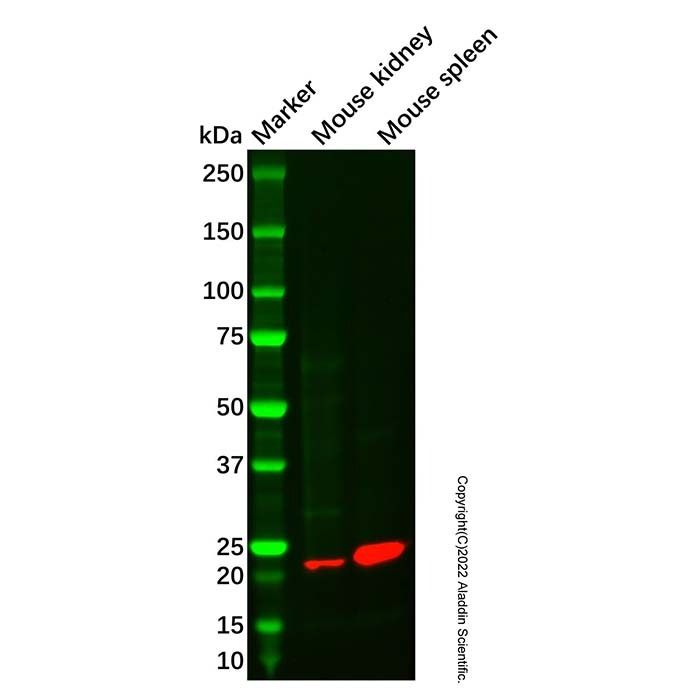 RGS1 Antibody -    by Aladdin Scientific