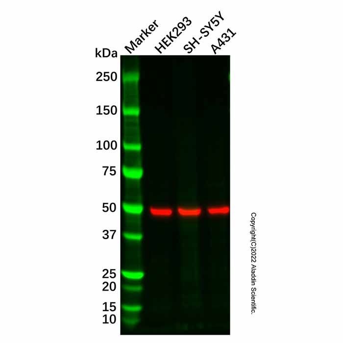Recombinant RGS9 Antibody -    by Aladdin Scientific