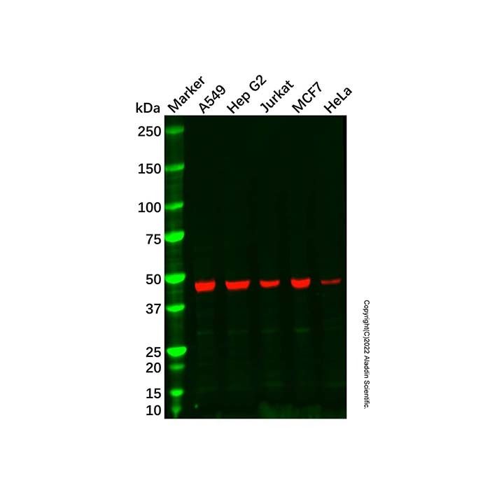 Ribonuclease Inhibitor/RAI Mouse mAb -    by Aladdin Scientific