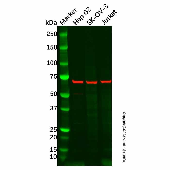 Recombinant Ribophorin I Antibody -    by Aladdin Scientific