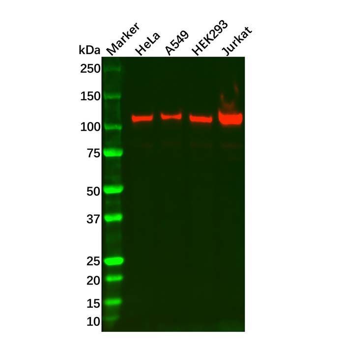 Recombinant RIG-I/DDX58 Antibody -    by Aladdin Scientific