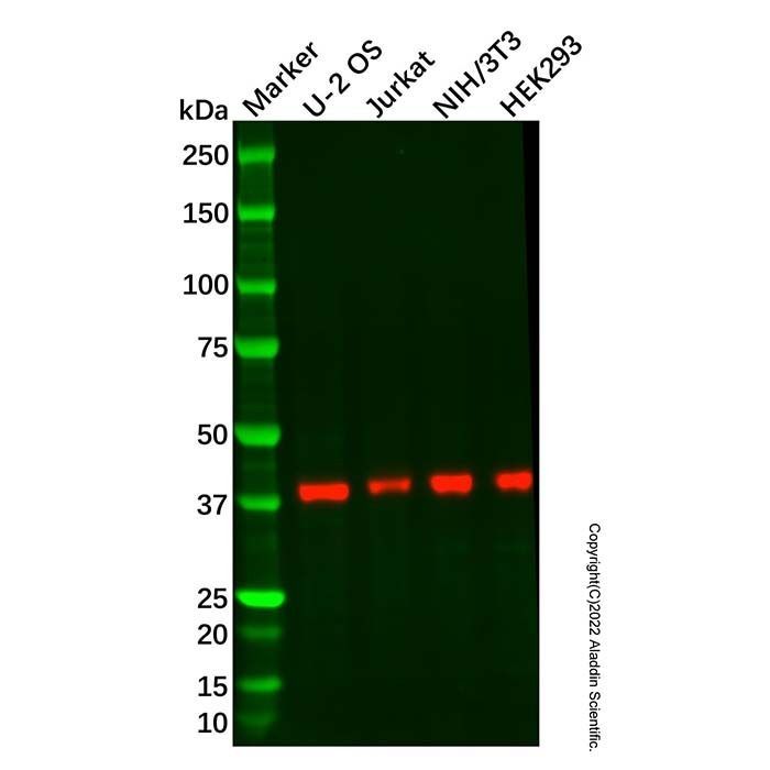Recombinant RING2/RING1B/RNF2 Antibody -    by Aladdin Scientific