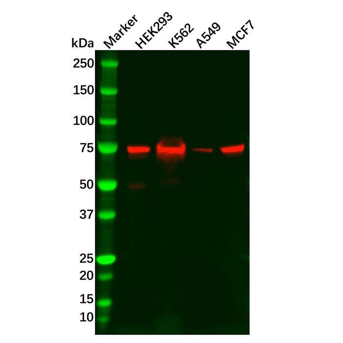 Recombinant RIP Antibody -    by Aladdin Scientific