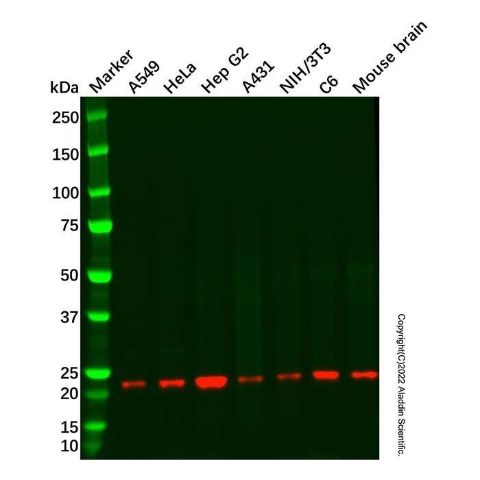 Recombinant RKIP Antibody -    by Aladdin Scientific