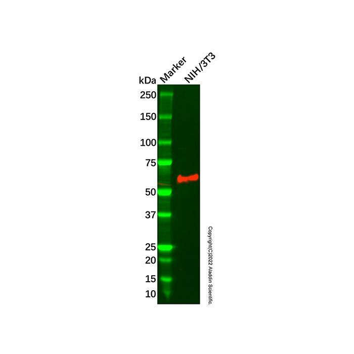 Recombinant RNase L Antibody -    by Aladdin Scientific