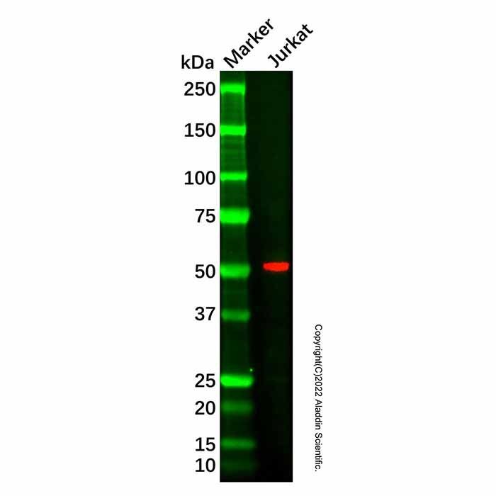 RNF21/IFP1 Mouse mAb -    by Aladdin Scientific