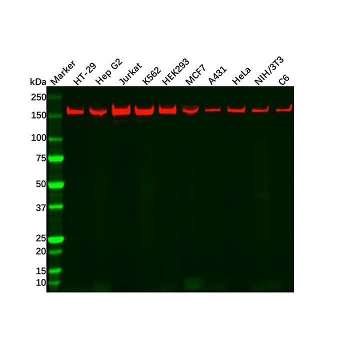 Recombinant ROCK1 Antibody -    by Aladdin Scientific