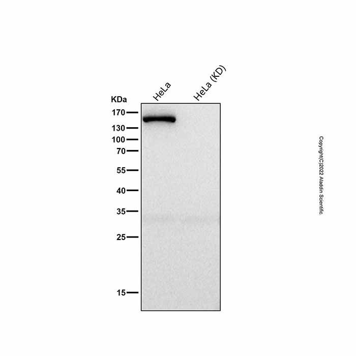 Recombinant ROCK2 Antibody -    by Aladdin Scientific