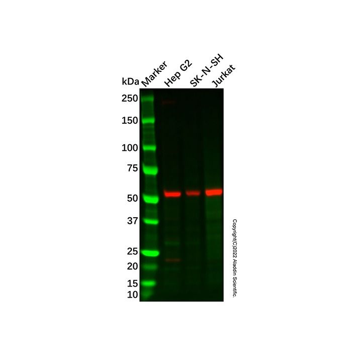 Recombinant ROR beta/RORB Antibody -    by Aladdin Scientific