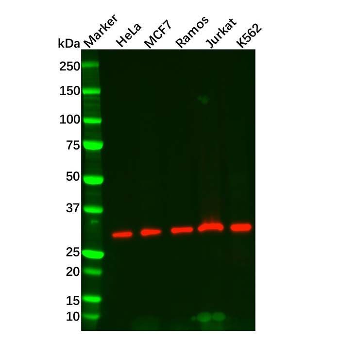 RPA32/RPA2 Mouse mAb -    by Aladdin Scientific