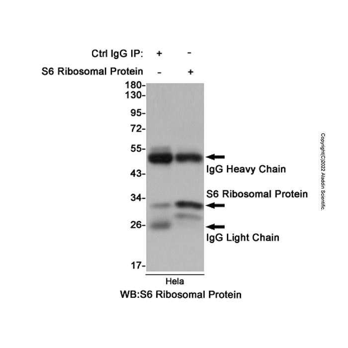 Recombinant RPS6 Antibody -    by Aladdin Scientific