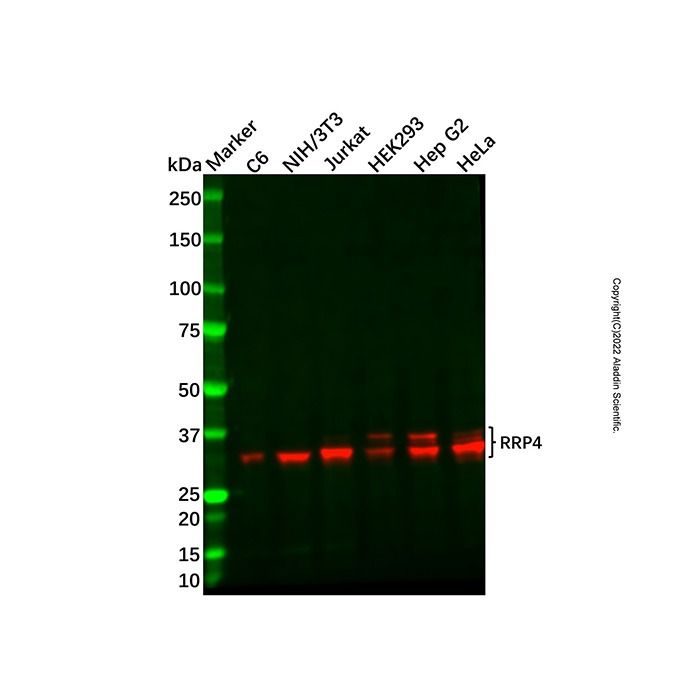 Recombinant RRP4 Antibody - by Aladdin Scientific