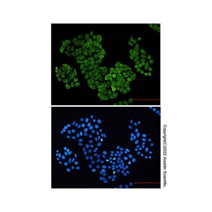Recombinant S100 alpha 6/PRA Antibody -    by Aladdin Scientific