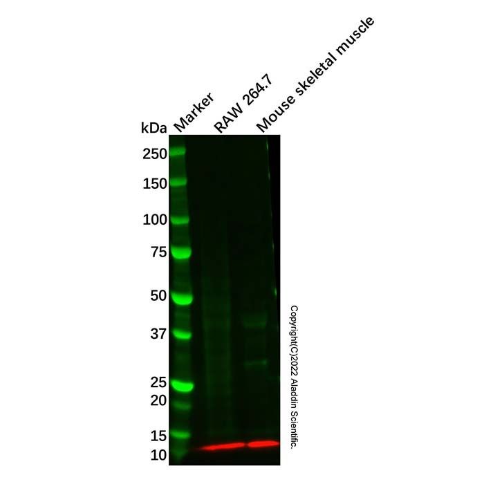 Recombinant S100 alpha Antibody -    by Aladdin Scientific