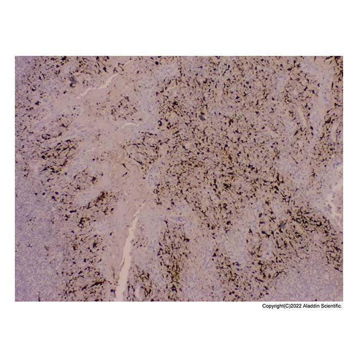 Recombinant S100 beta Antibody -    by Aladdin Scientific