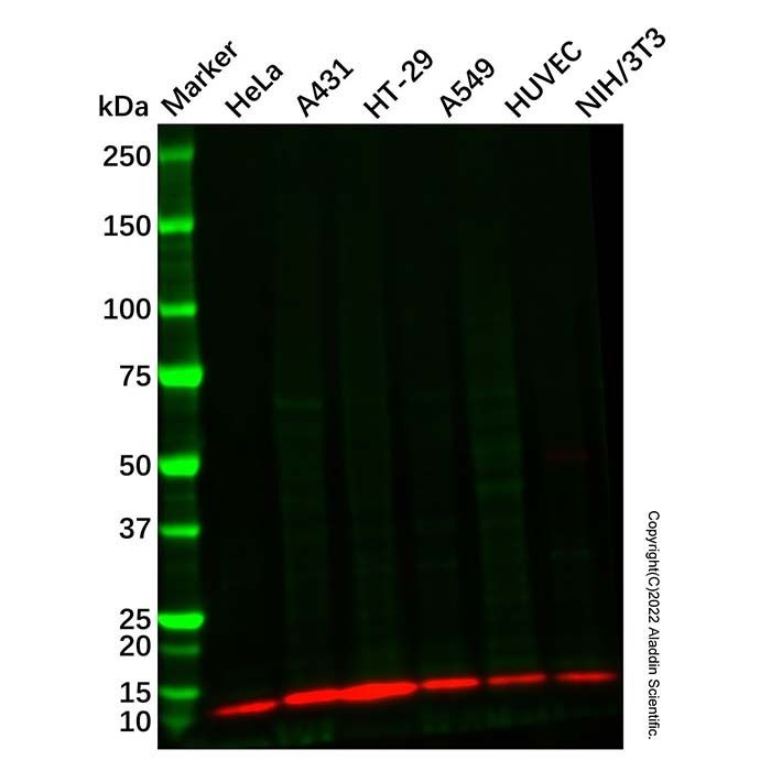 S100A10 Mouse mAb -    by Aladdin Scientific
