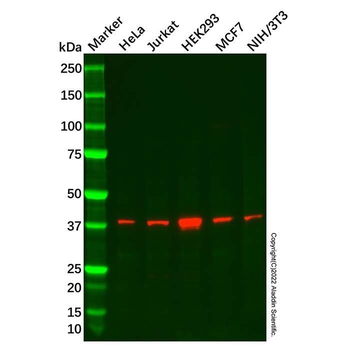 Recombinant SAE1 Antibody -    by Aladdin Scientific
