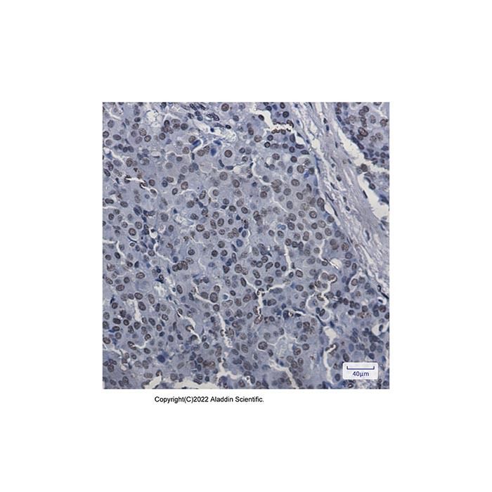 Recombinant SAFB Antibody -    by Aladdin Scientific
