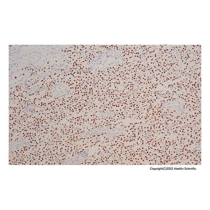 Recombinant Sall4 Antibody -    by Aladdin Scientific