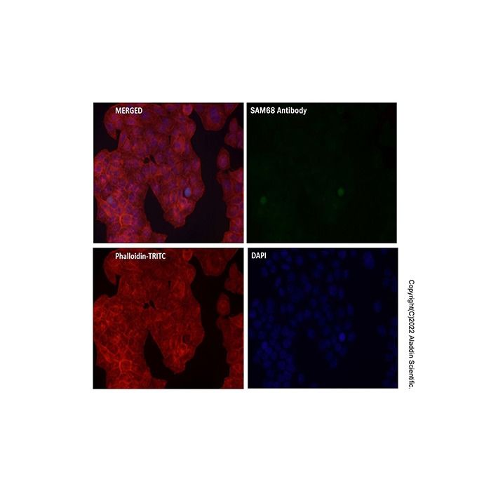 Recombinant SAM68 Antibody -    by Aladdin Scientific