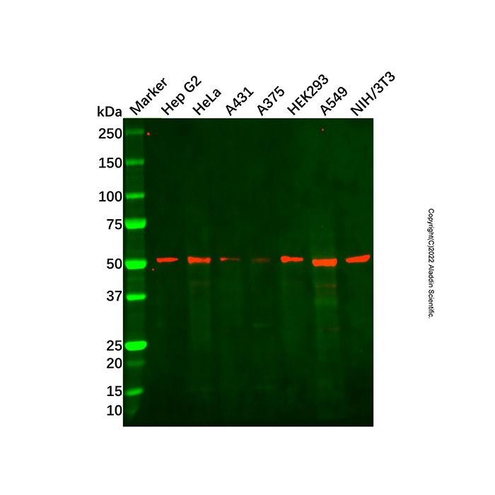 Recombinant SAMM50/SAM50 Antibody -    by Aladdin Scientific