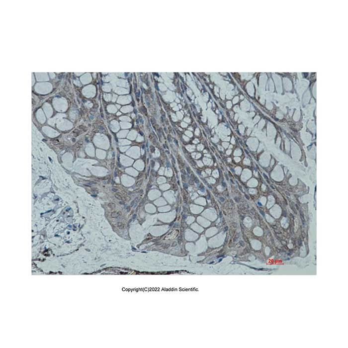 Recombinant Sarcomeric Alpha Actinin Antibody -    by Aladdin Scientific
