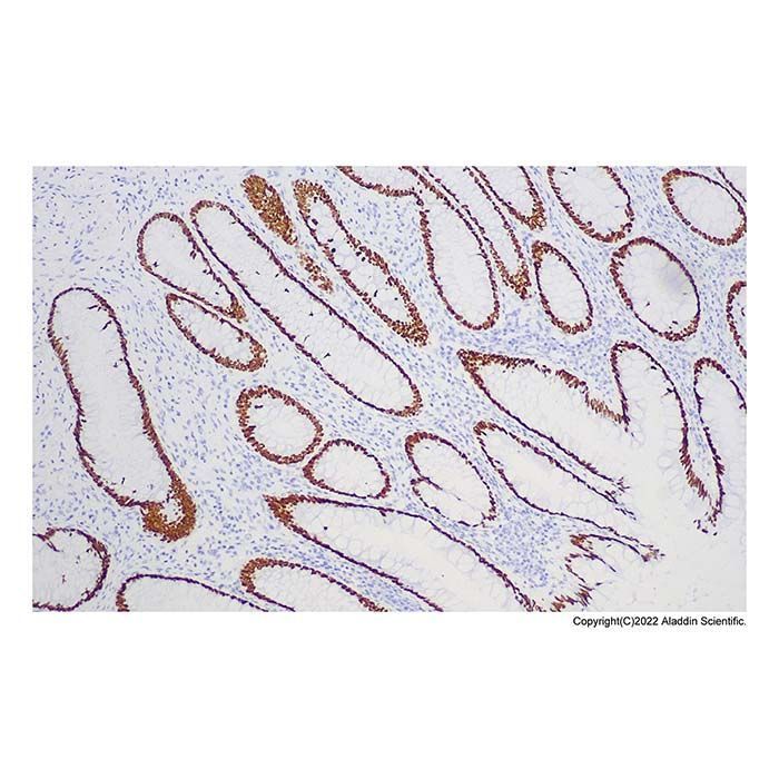 Recombinant SATB2 Antibody -    by Aladdin Scientific
