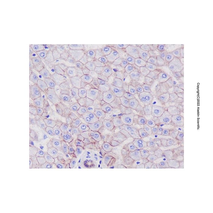Recombinant Scavenging Receptor SR-BI Antibody -    by Aladdin Scientific