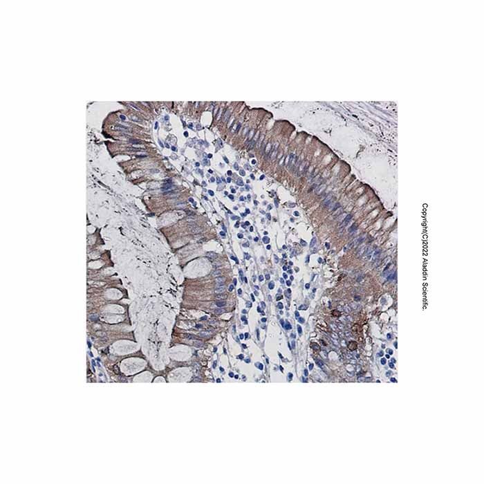 Recombinant SCIN Antibody -    by Aladdin Scientific