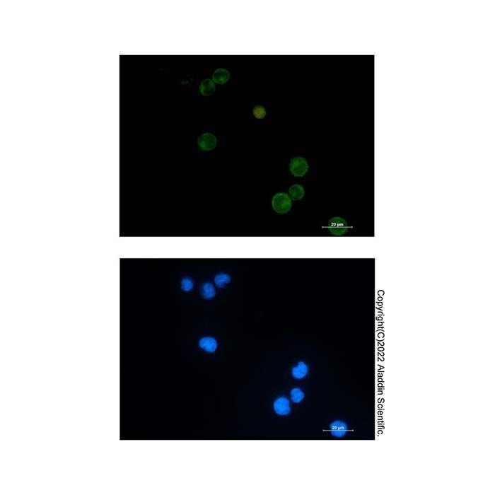 Recombinant Semaphorin 4D/CD100 Antibody -    by Aladdin Scientific