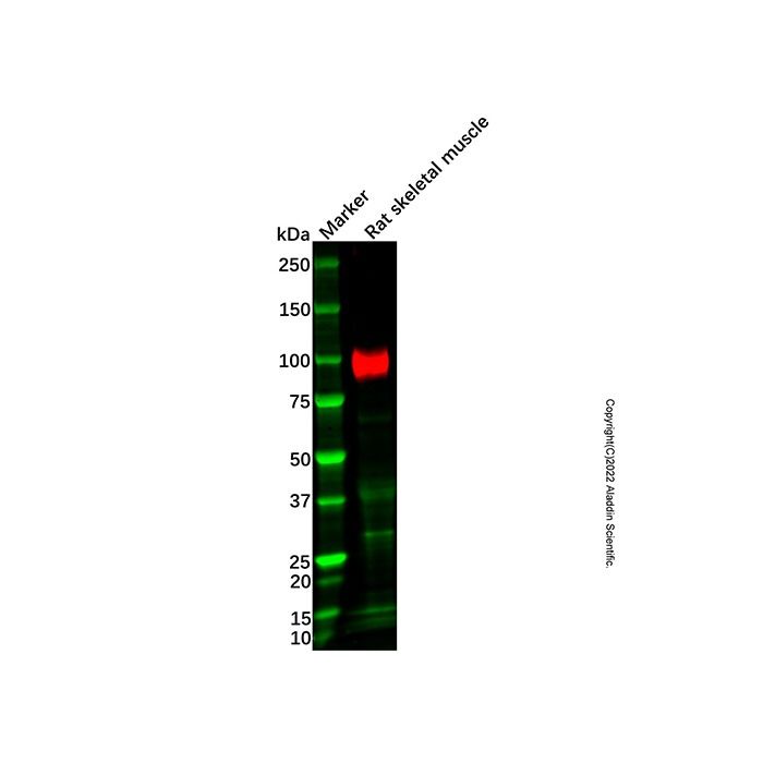 Recombinant SERCA1 ATPase Antibody -    by Aladdin Scientific