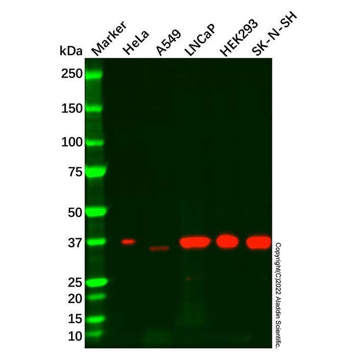 Recombinant Serine racemase Antibody -    by Aladdin Scientific