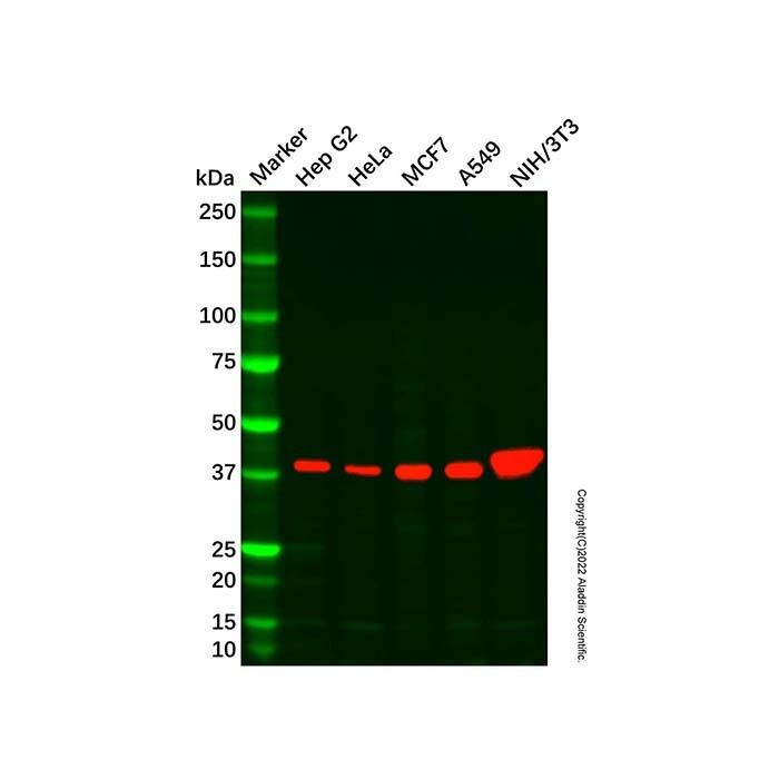 SerpinB6/CAP Mouse mAb - by Aladdin Scientific