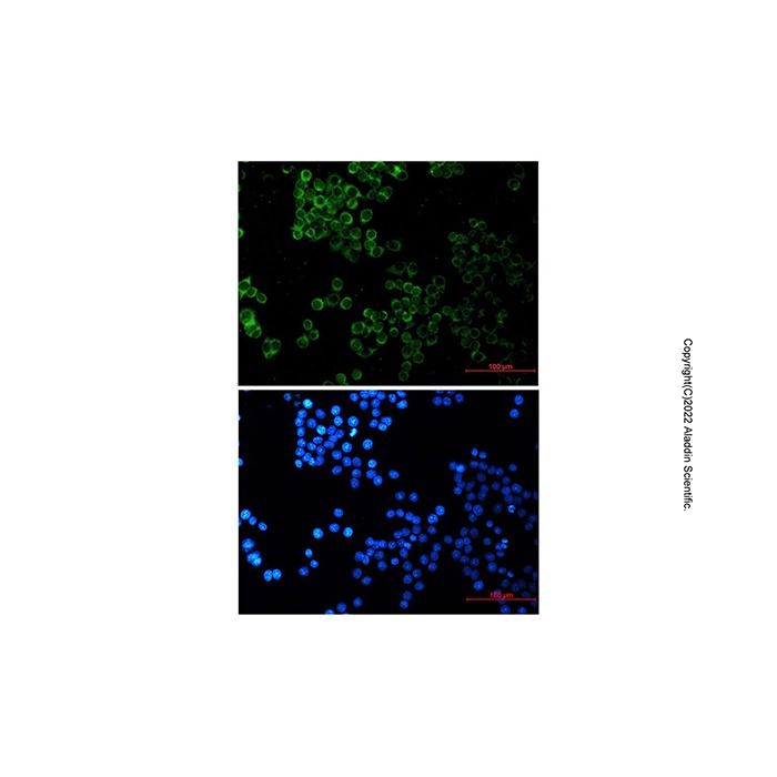 Recombinant SESN2/Sestrin-2 Antibody -    by Aladdin Scientific