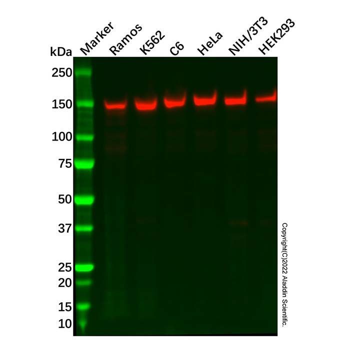 Recombinant SF3B1 Antibody - by Aladdin Scientific