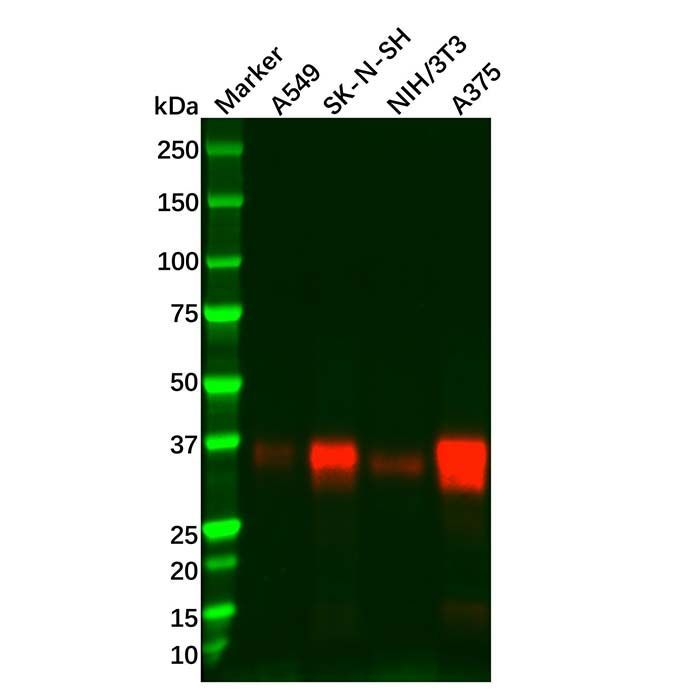 Recombinant SFRP1 Antibody -    by Aladdin Scientific