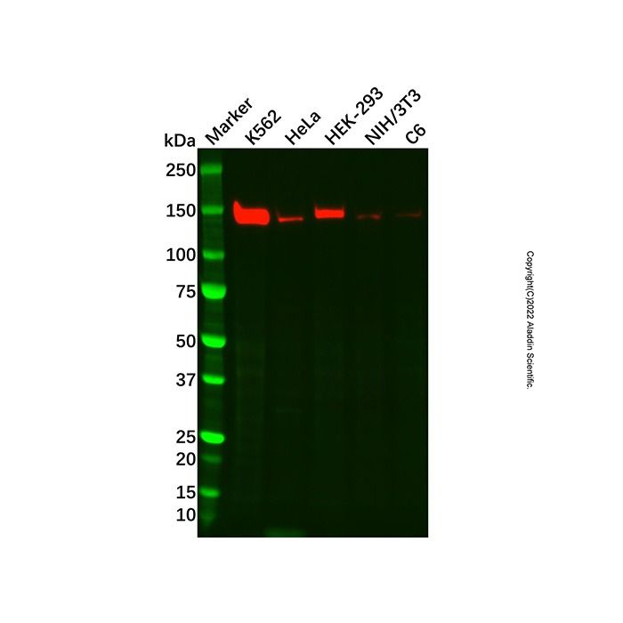Recombinant SGSM1/RUTBC2 Antibody -    by Aladdin Scientific