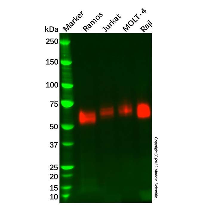 Recombinant SLAMF6 Antibody -    by Aladdin Scientific
