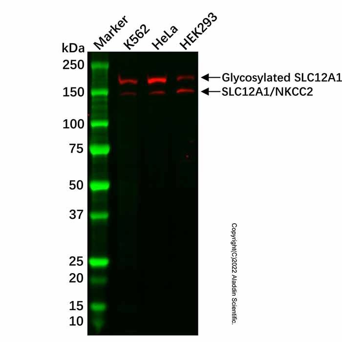 Recombinant SLC12A1/NKCC2 Antibody -    by Aladdin Scientific